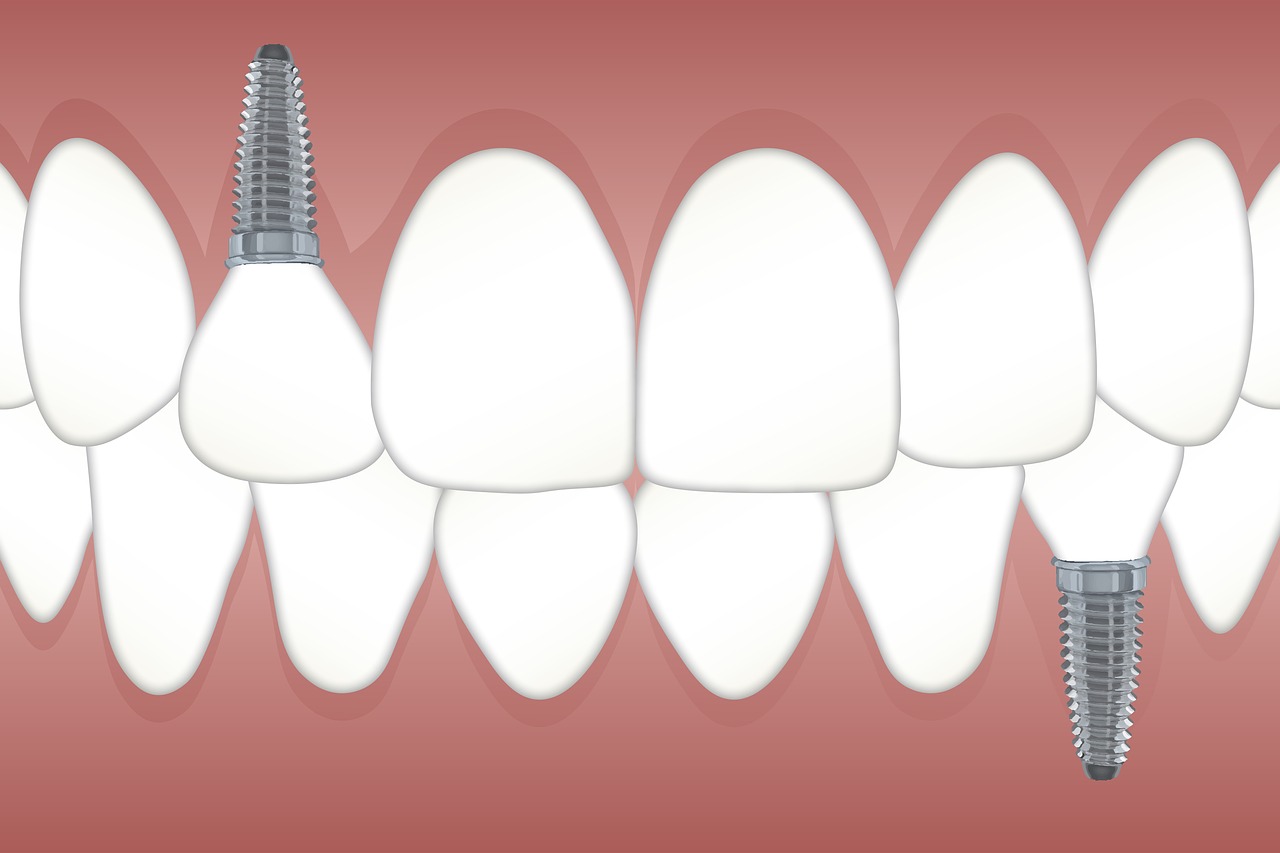 teeth-3597679_1280.jpg